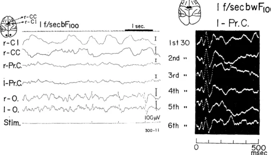 Fig.  3.1.  EEGs  and  photically  evoked  potentials  in  the  motor  cortex. 