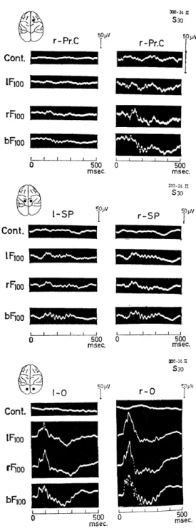 Fig.  3.2.  Visually  evoked  potentials  in  the              motor cortex. 