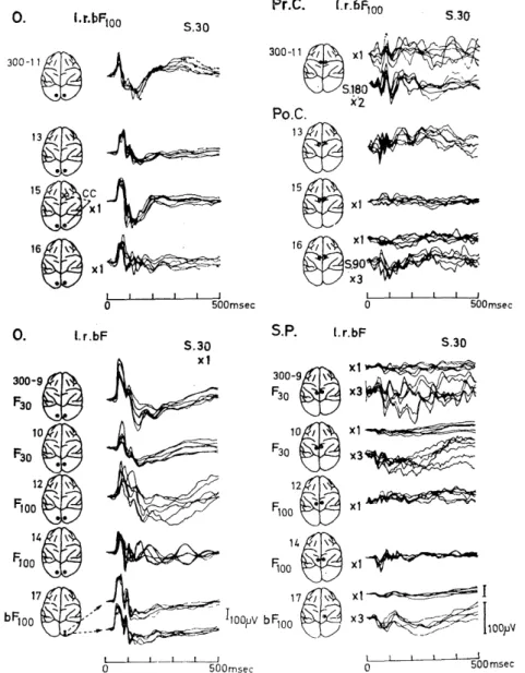 Fig.  3.4.  Visually  evoked  potentials  in  the  motor,  somatosensory,  and  superior            parietal cortex in  comparison with that in  the  visual cortex,