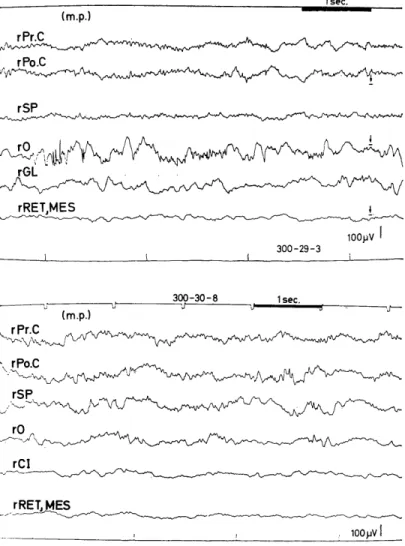 Fig.  2.1-1.  Background  EEGs  of  Group  I  visually  evoked  potential-             s  in the visual cortex