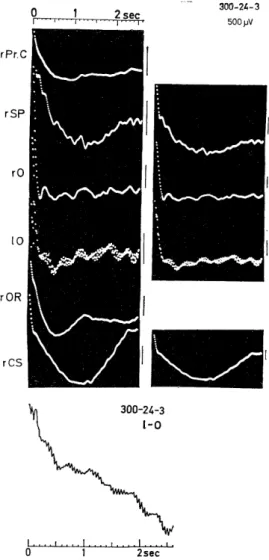 Fig.  2.1-2.  An  example  of  autocorrelo- autocorrelo-grams  of  background  EEGs. 