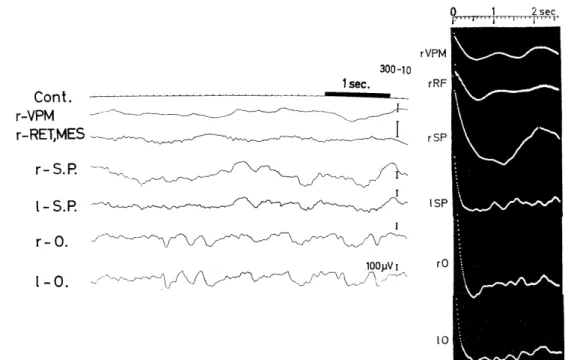 Fig.  2.2.  Background  EEGs  and  their  autocorrelograms  of  an  animal  (300-10)            showing  visually evoked  potentials of  Group  IV