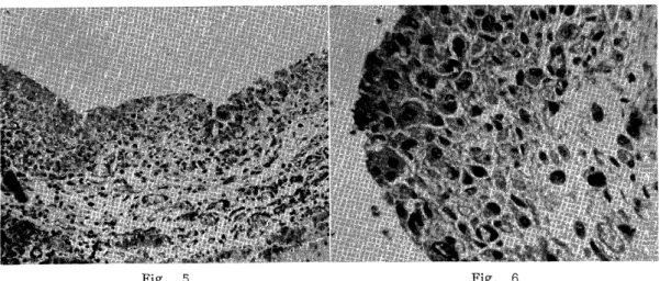 Fig.  5 Fig.  6