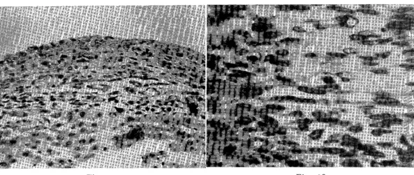 Fig.  11 Fig.  12