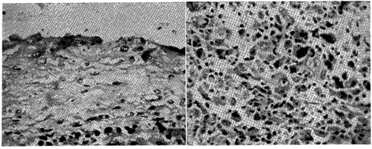 Fig.  17 Fig.  18