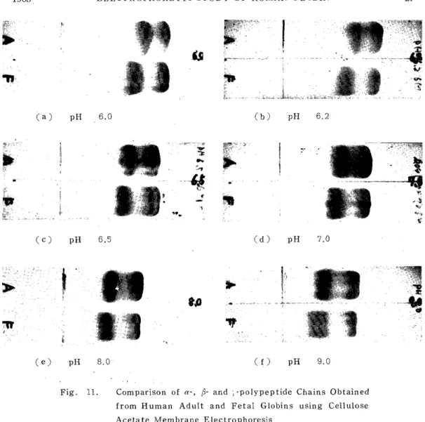 Fig.  11.  Comparison  of  a-,  R-  and  ; -polypeptide  Chains  Obtained             from  Human Adult and  Fetal Globins using  Cellulose 
