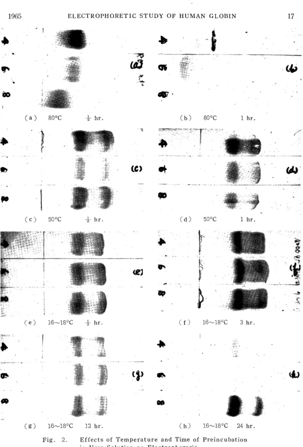 Fig.  2.  Effects  of  Temperature  and  Time  of  Preincubation             in  Urea  Solution on  Electrophoresis 