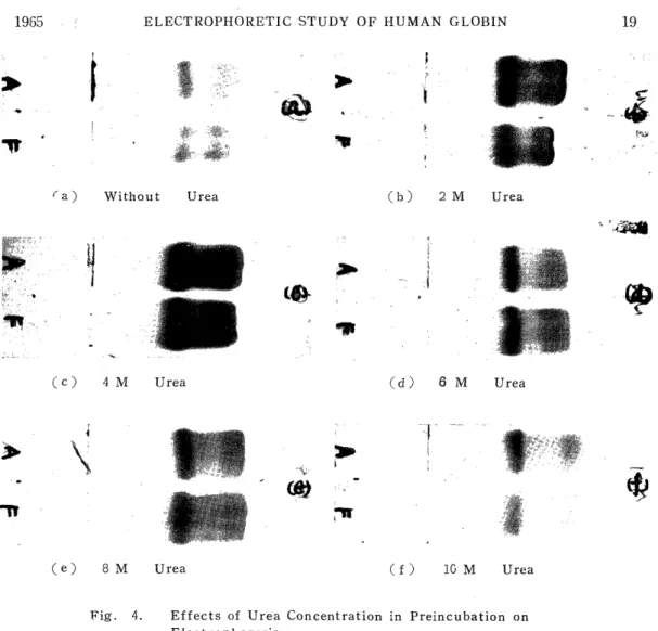 Fig.  4.  Effects  of  Urea  Concentration  in  Preincubation  on            Electrophoresis 