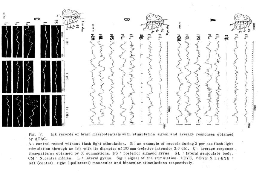 Fig.  2.  Ink  records  of  brain  masspotentials  with  stimulation  signal  and  average  responses  obtained  by  ATAC