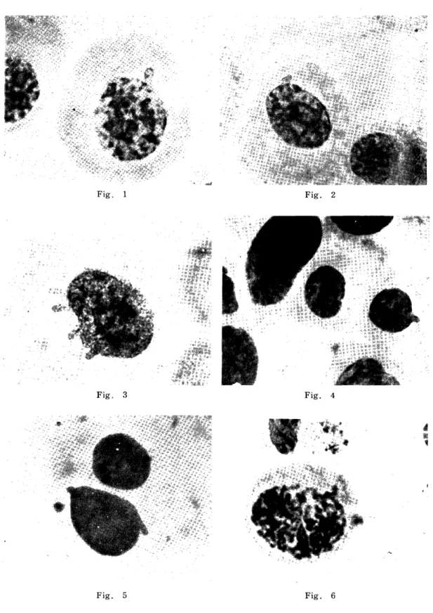 Fig.  1  Fig.  2