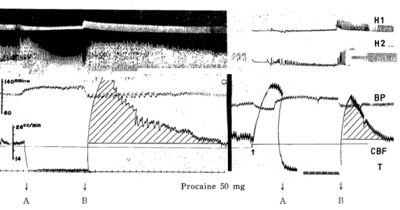 FIG.  5.  Effect  of  procaine  on  reactive  hyperemia.  Records  as  in  Fig.  1.
