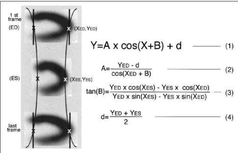 FIGURE 3. After the manual identification of the apex and the base at both end-diastole (ED) and end-systole (ES), the locations if the ED and ES frames were automatically determined using the function Y ⫽ A ⫻ cos (X ⫹ B) ⫹ d.