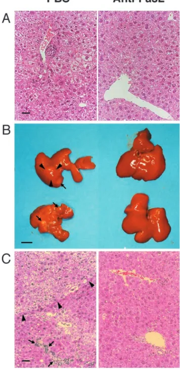 Figure 2. Prevention of progressive liver dysplasia and HCC develop- develop-ment by anti-FasL mAb treatdevelop-ment