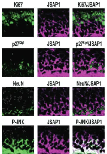 Fig. 2  ■   Expression of the scaffold protein JSAP1 and active  JNK in developing mouse cerebellum