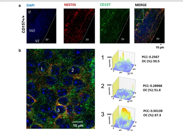 Fig. 2  Immunohistochemical analysis of CD157 expression in the embryonic brain. a Representative images from the E17 embryonic hypothala‑