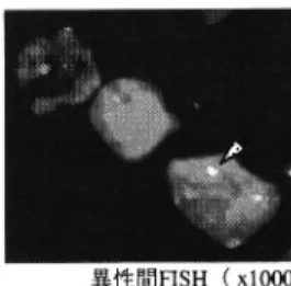 図 4  異性 間骨髄移植症例 におけるMay・ Giemsa染 色 とFISH染 色