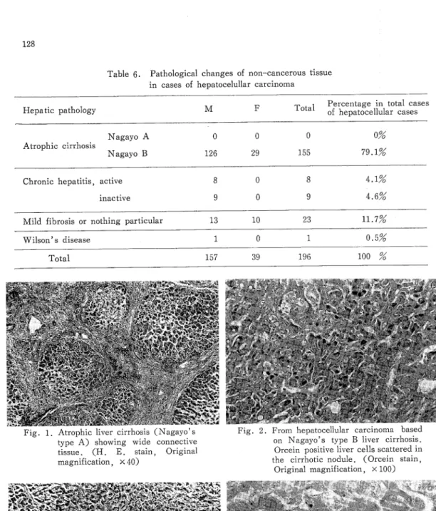 Table 6. Pathological changes of non‑cancerous tissue in cases of hepatocelullar carcinoma