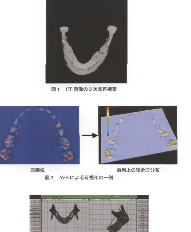 図 1 CT 薗像の 3 次元再構築 原画像 歯列上の睦合圧分布 図 2 AVS による可視化の一例 ν  図 3 下顎運動の可視化 ‑ 2 0 ー