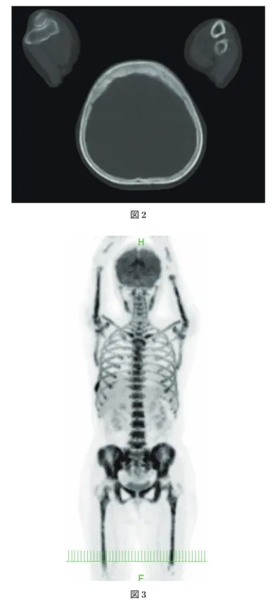 Figure 3 Figure 1 