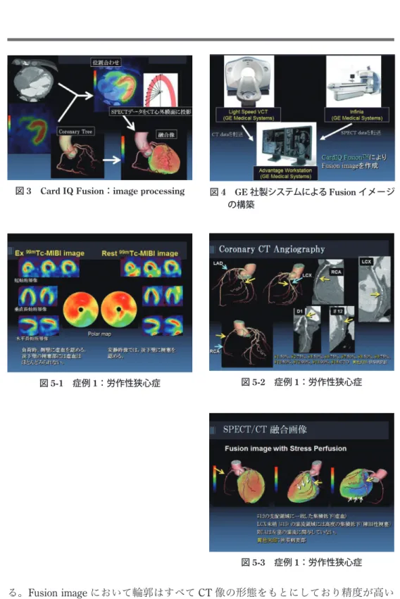 図 5-1 症例 1：労作性狭心症 図 5-2 症例 1：労作性狭心症