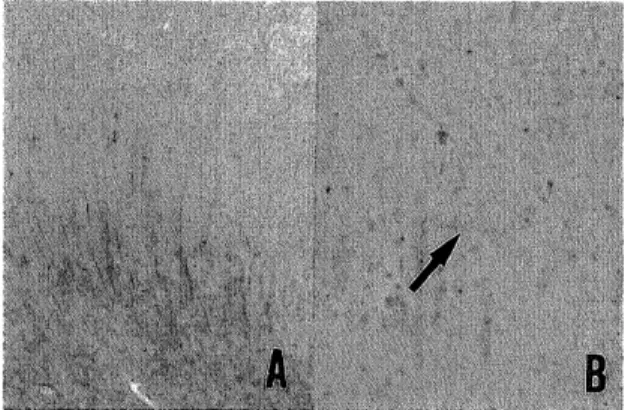 Fig . 8 . I m m 11 n O r e a C ti v e 丘b e r s i n t h e c e r e b r a l c o r t e x ( a r e a 2 1 ) 