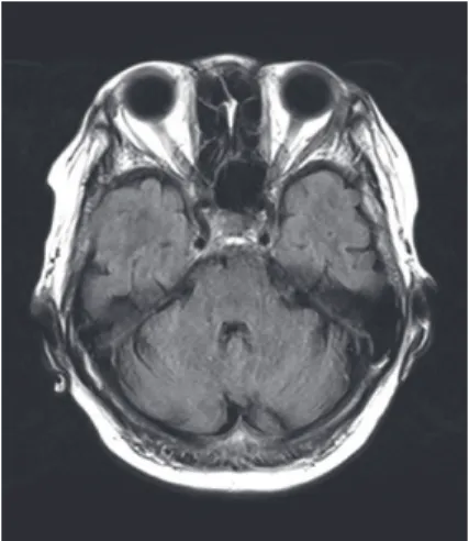 Fig 2. Operative view.