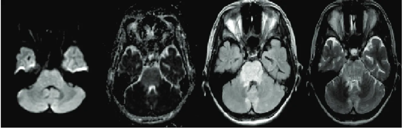 図 1. 入院時頭部 MRI 検査