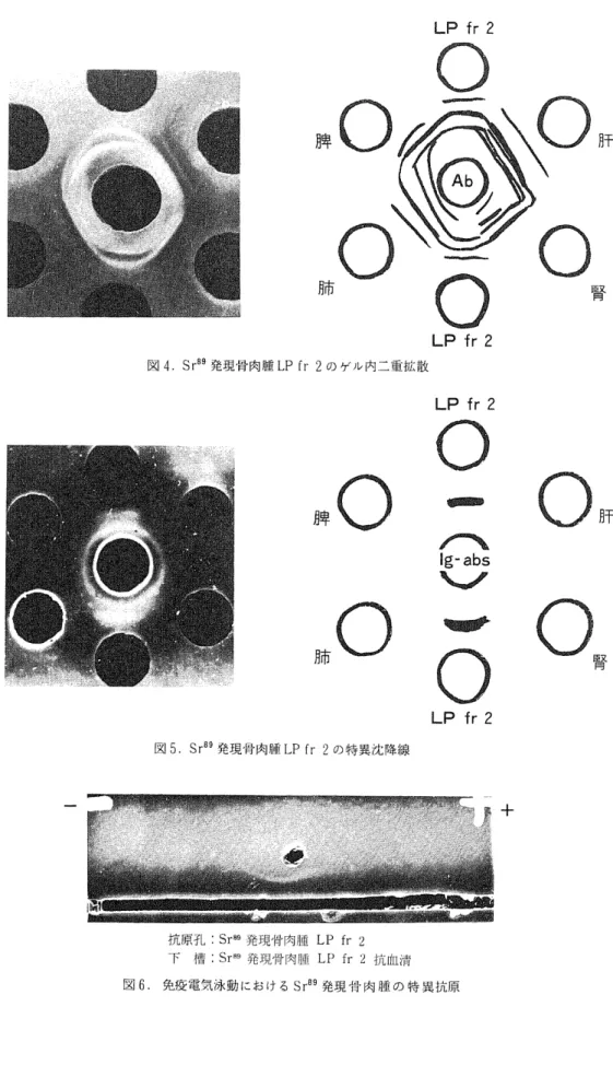 図 4 . S r 8 9 発 現 骨 肉 腫 L P f r 2 の ゲ ル 内 二 重 拡 散 牌 ◎ 肺 の 図 5 . S r 8 9 発 現 骨 肉 腫 L P f r 2 の 特 異 沈 降 線 芸 三L Pfr2≡:嘲圃砲 砂〆『8g‑absW‑∑予感圏L P･什 2 抗 原孔 : S r 8 9 発 現 骨 肉 腫 L P f r 2 下 情 : S r B 9 発 現 骨 肉 腫 L P f r 2 抗 血 清 図 6 