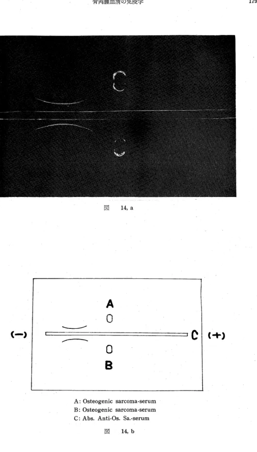 図  14，a 《r・》 A0 0 0 《・＋．） A：Osteogenic sarcOma・serum B：Osteogenic sarcoma・serum C：Abs． Anti・Os． Sa．・serum 図 ．14，b