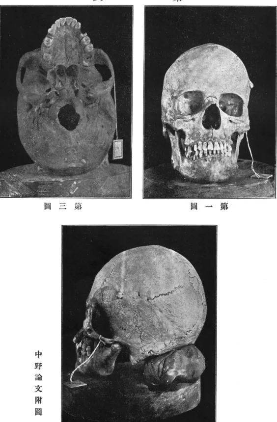 表 第 一圖