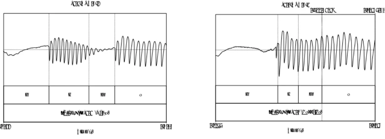Figure  1:  An  EGG  signal  of  /higo/  produced  by  a  Kanto  speaker  (left)  and  a  Hokkaido  speaker  (right)
