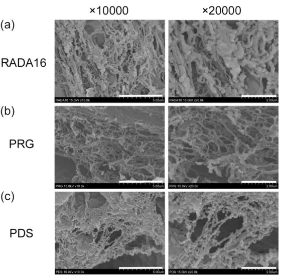 FIGURE S2 SEM analysis of the SAP hydrogels used. 