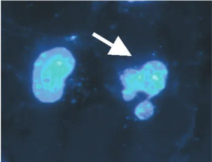 Fig. 2 ■ Apoptosis induced by a constitutively active JNK MAP kinase