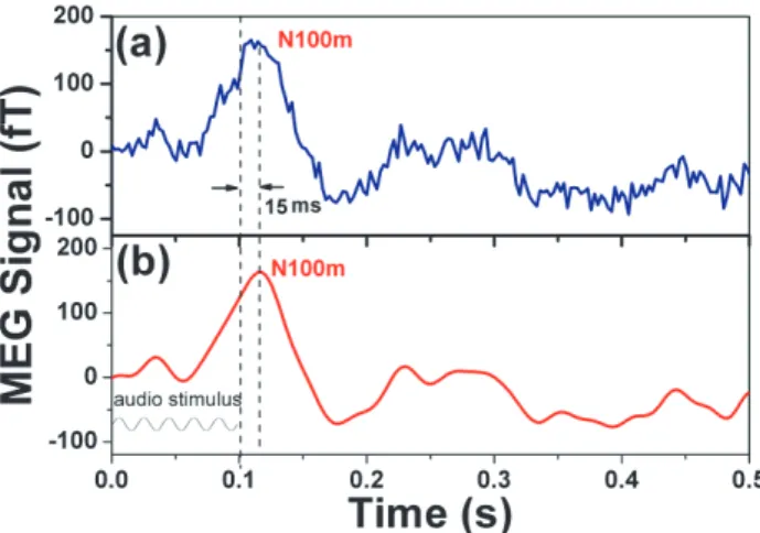 Fig. 7 Auditory evoked magnetic field with 100 times average:
