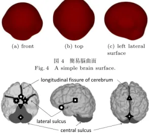 図 5 解剖学的特徴 (大脳縦列・外側溝・小脳) Fig. 5 Landmarks of brain (longitudinal ﬁssure of