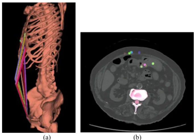 Fig. 2 The e ﬀ ect of the mid-point (left side): (a) 3D image of the center- center-lines, (b) slice image at the mid-point.