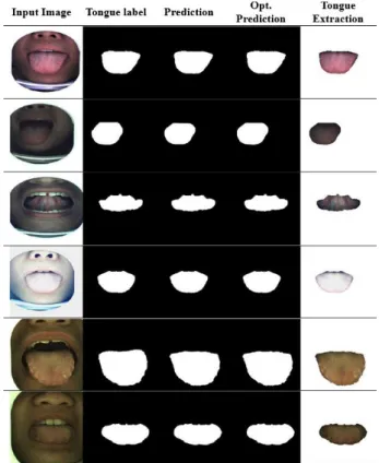 Fig. 5 The segmentation results of Design v4 on the test dataset. “Predic- “Predic-tion” means the results are directly generated from the network