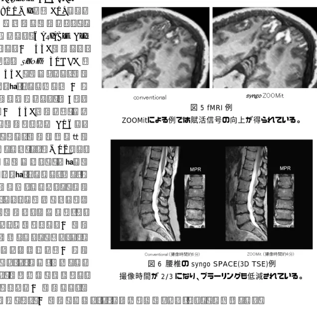 図 5 fMRI 例 