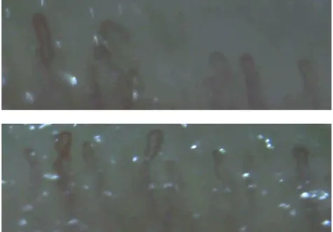 Figure 1.2: The image of capillaries taken by a microscope. The upper and below images are taken from different fingertips.