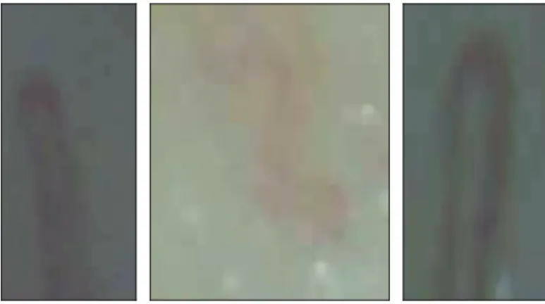 Figure 4.1: The three selected images of capillary taken by a microscope.