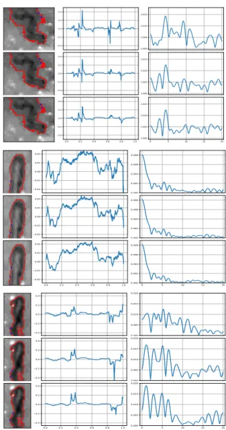 Figure 3: The evolution of the given curve (red) on the given three different images.