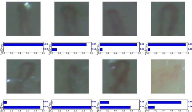 Figure 7: The results of the model when it is applied to the images of capillary taken by a microscope.
