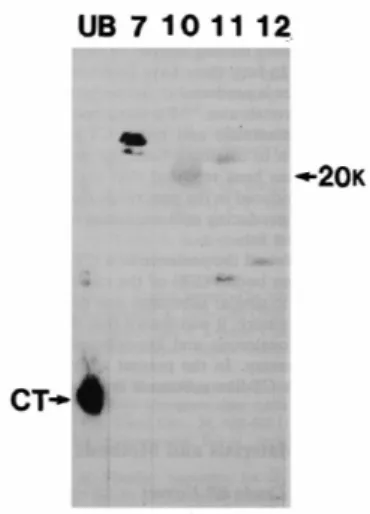 Fig. 5. Molecular weights of immunoreactive calcitonin (CT) in medaka Brockmann body extract