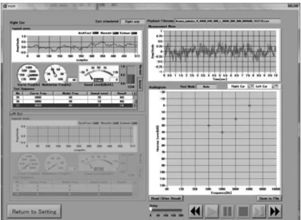 図 7 　Output window example of estimated audiogram of 40-Hz ASSR.