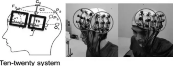 Fig. 1.   Positioning and installation of the probes.