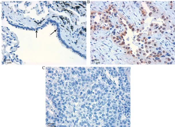 Figure 1. Expression of IER3 evaluated by immunohistochemistry. (A) Respiratory bronchiole