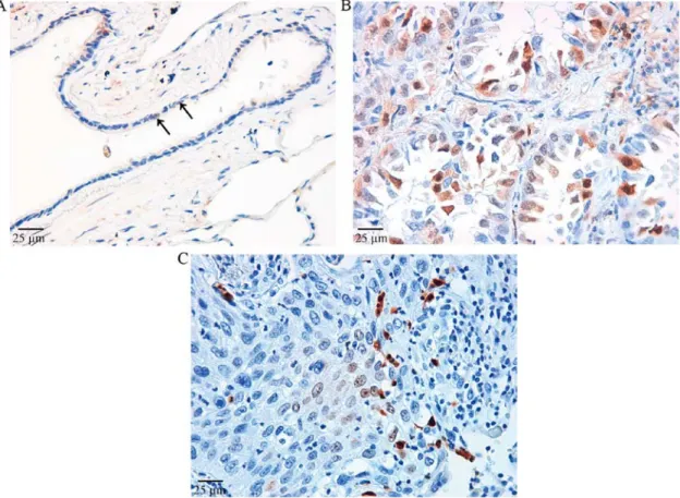 Figure 3. Expression of phosphorylated ERK (pERK) evaluated by immunohistochemistry. (A) Respiratory bronchiolar epithelia