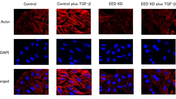 Fig. S3.   Knockdown of EED antagonized TGF-β-induced actin fiber formation of A549 cells