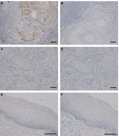 Table 2 displays the correlations between VEGF-A and VEGF-C expression and the patients ’ clinicopathological