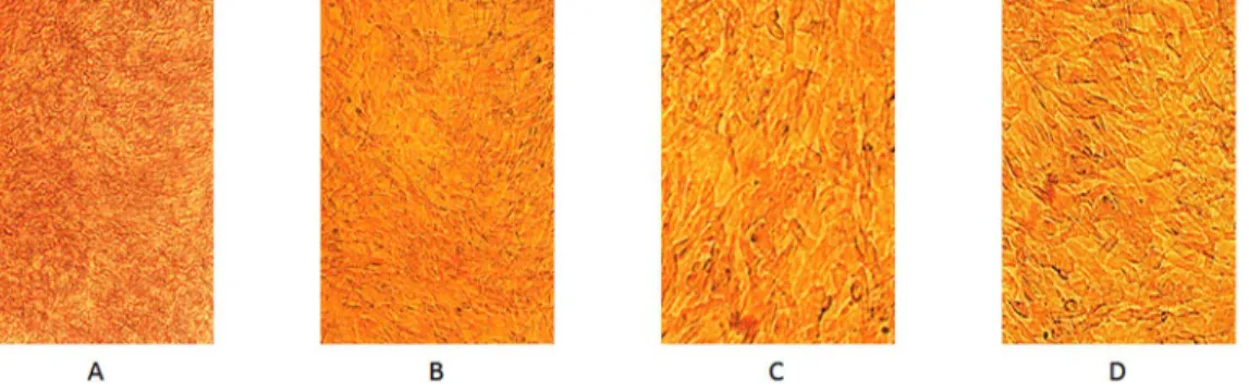 Figure 1. 46 microscopic view(A) shows the over fluent state of ADSCs sheets. 106 microscopic view(B) shows there is no space between the ADSCs of the sheets